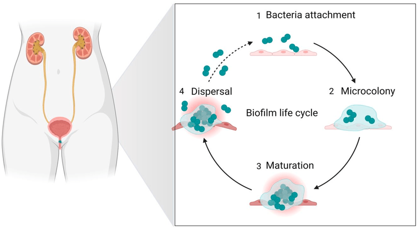 Biofilms, Recurrent UTIs, and Why Most Approaches Fail - Bladder Rx Reset